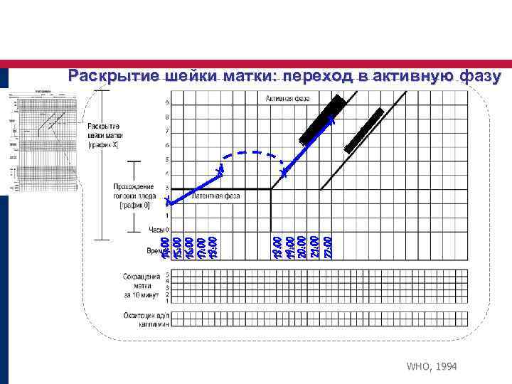 Раскрытие шейки матки: переход в активную фазу X X X 18: 00 19: 00