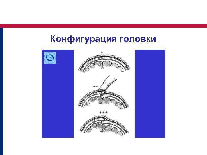 Конфигурация головки 