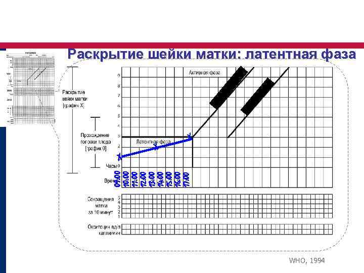 Раскрытие шейки матки: латентная фаза 09: 00 10: 00 11: 00 12: 00 13: