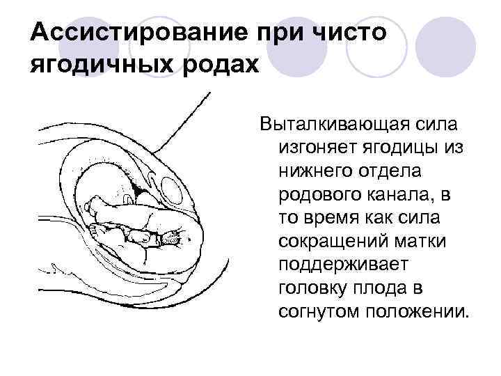 Чисто ягодичное предлежание плода