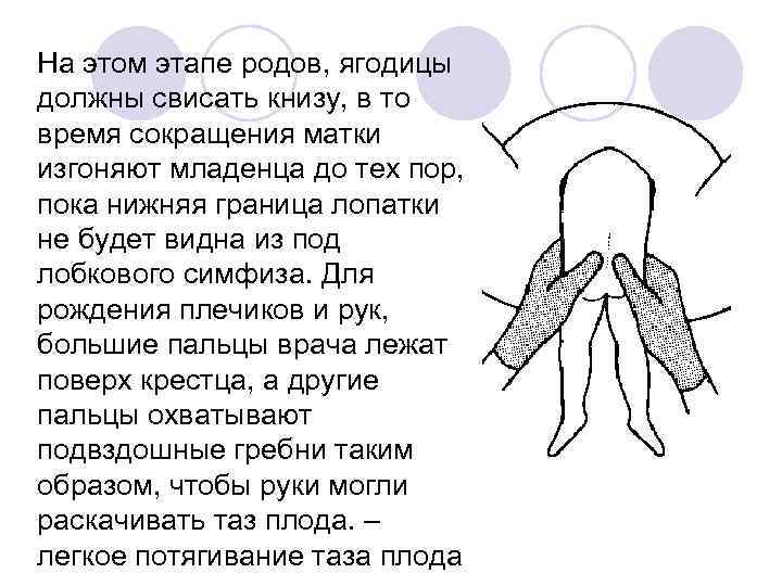 На этом этапе родов, ягодицы должны свисать книзу, в то время сокращения матки изгоняют