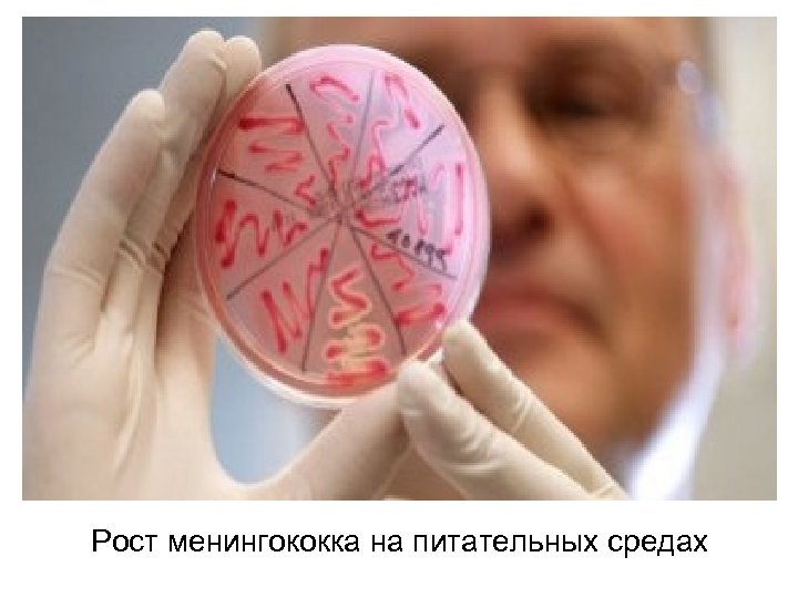 Рост менингококка на питательных средах 