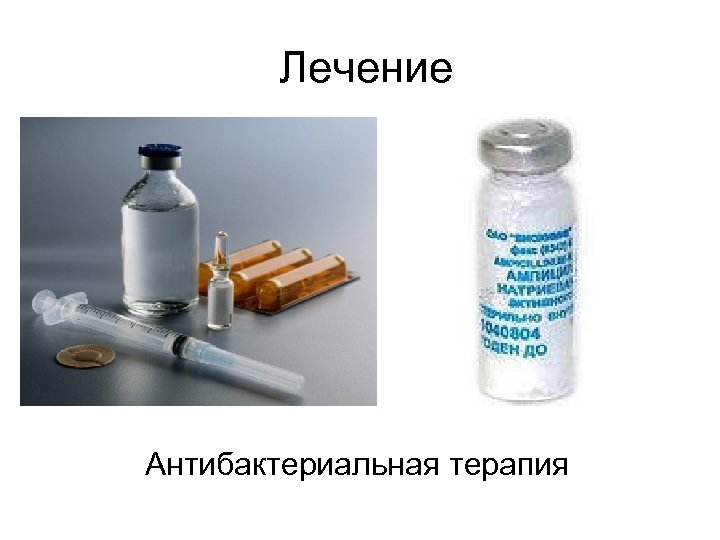 Лечение Антибактериальная терапия 