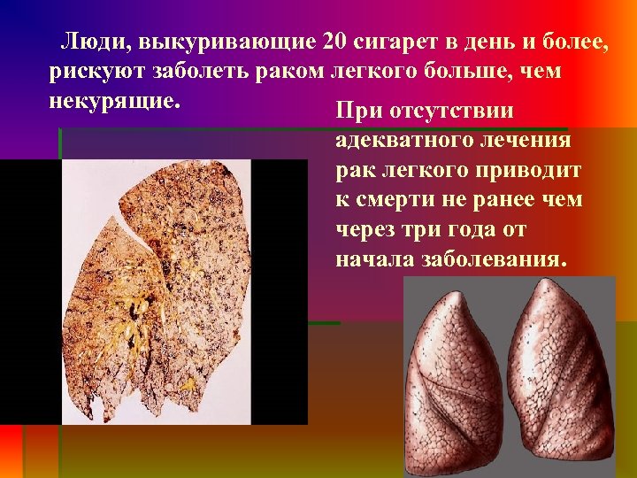 Люди, выкуривающие 20 сигарет в день и более, рискуют заболеть раком легкого больше, чем