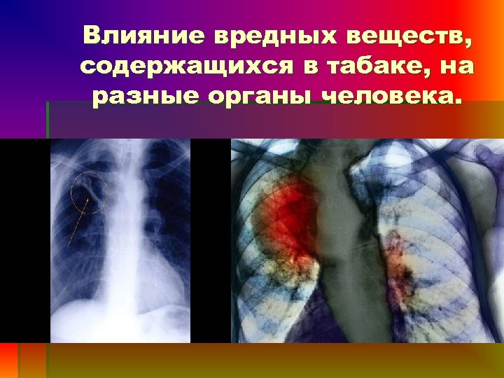 Влияние вредных веществ, содержащихся в табаке, на разные органы человека. 
