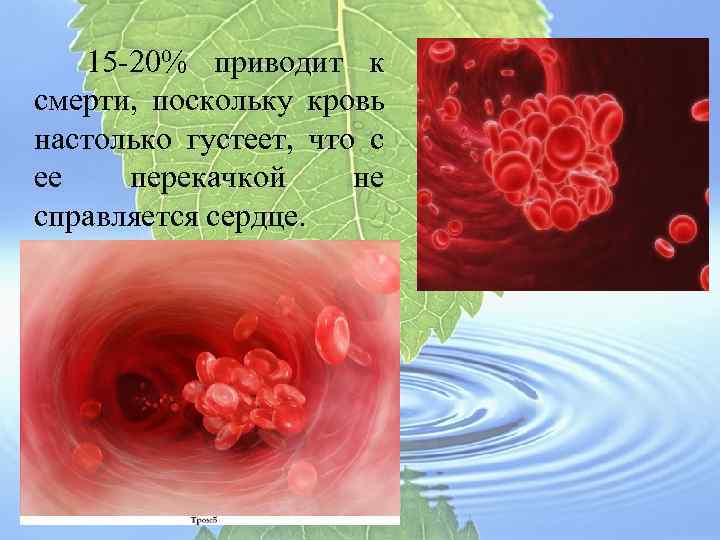  15 -20% приводит к смерти, поскольку кровь настолько густеет, что с ее перекачкой