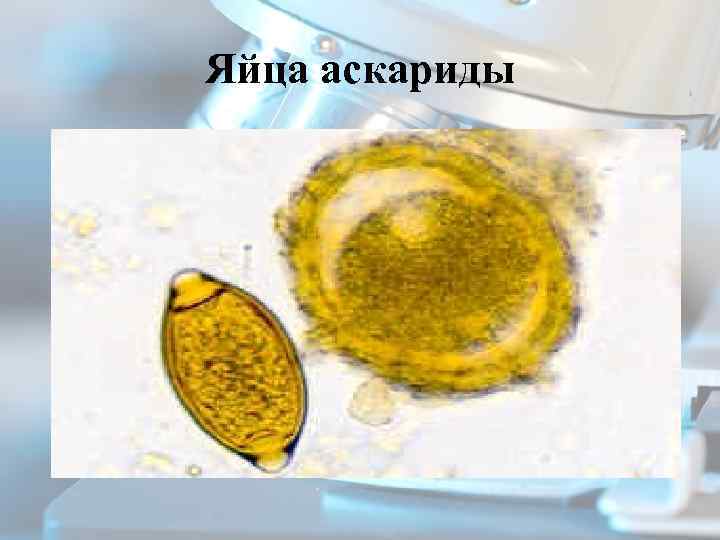 Яйца аскариды 