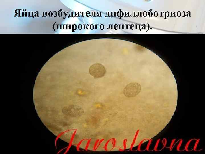Яйца возбудителя дифиллоботриоза (широкого лентеца). 