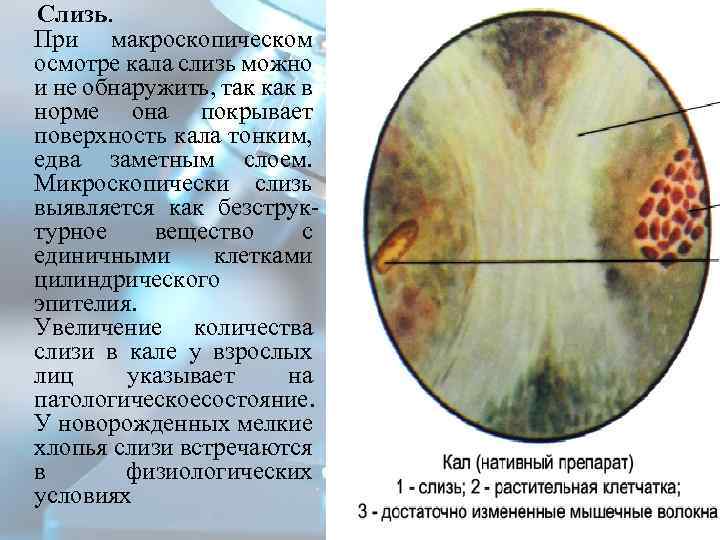 Видимые слизистые