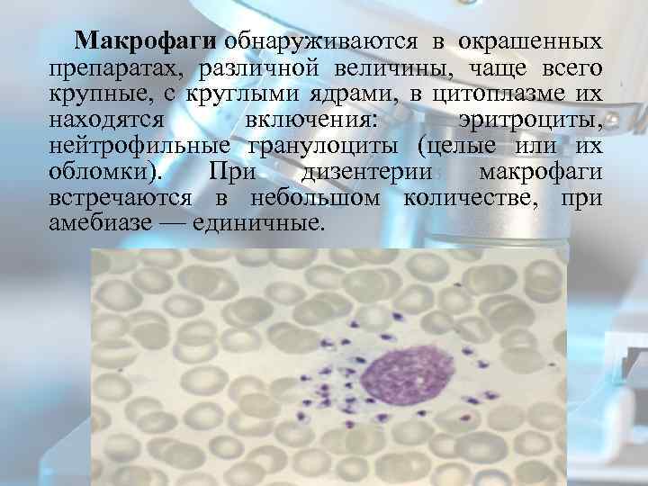 Гранулоциты макрофаги