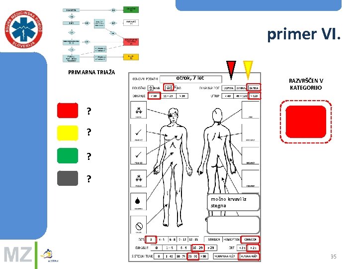 primer VI. PRIMARNA TRIAŽA otrok, 7 let ? ? RAZVRŠČEN V KATEGORIJO močno krvavi