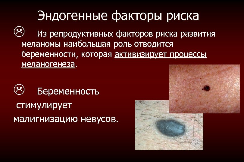 Эндогенные факторы риска L Из репродуктивных факторов риска развития меланомы наибольшая роль отводится беременности,