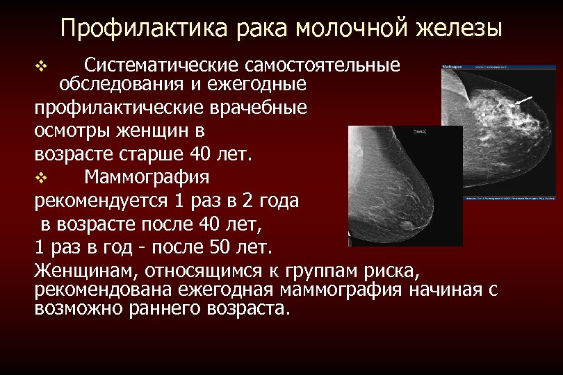 Профилактика рака молочной железы Систематические самостоятельные обследования и ежегодные профилактические врачебные осмотры женщин в