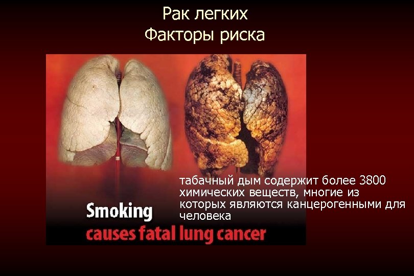Рак легких Факторы риска табачный дым содержит более 3800 химических веществ, многие из которых