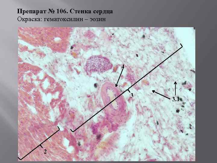 Препарат № 106. Стенка сердца Окраска: гематоксилин – эозин 4 3 2 3. 1