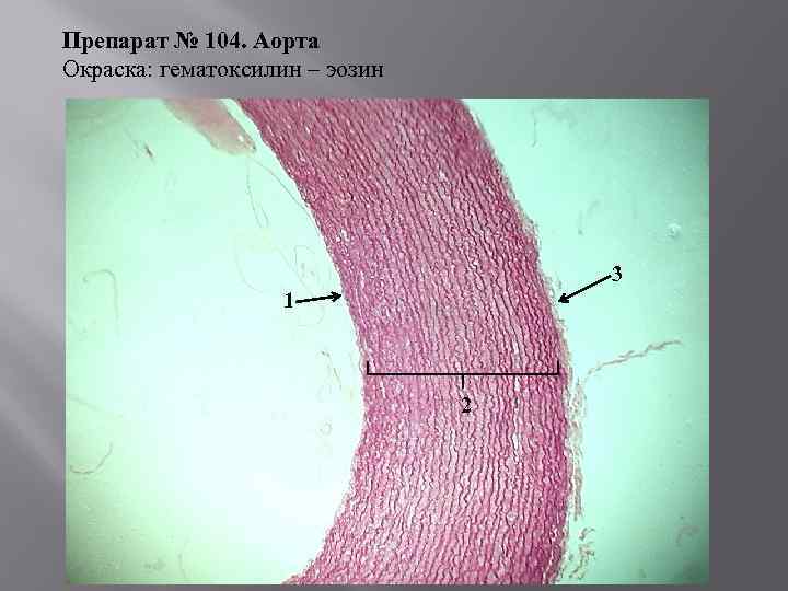 Препарат № 104. Аорта Окраска: гематоксилин – эозин 3 1 2 