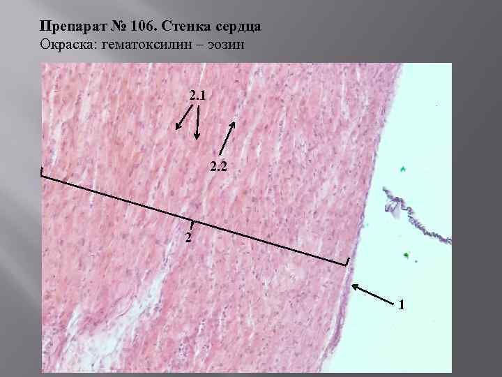 Препарат № 106. Стенка сердца Окраска: гематоксилин – эозин 2. 1 2. 2 2