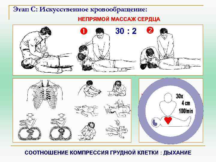 Соотношение непрямого массажа сердца