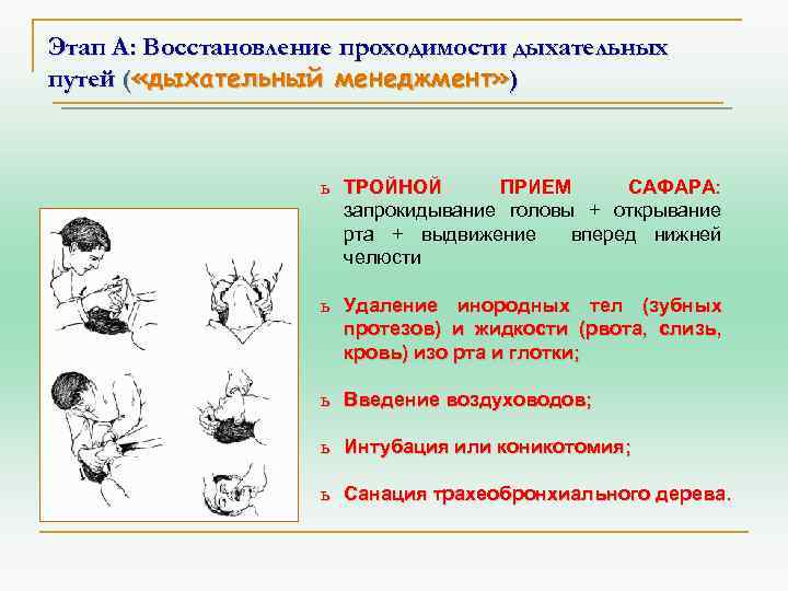 Этап А: Восстановление проходимости дыхательных путей ( «дыхательный менеджмент» ) ь ТРОЙНОЙ ПРИЕМ САФАРА: