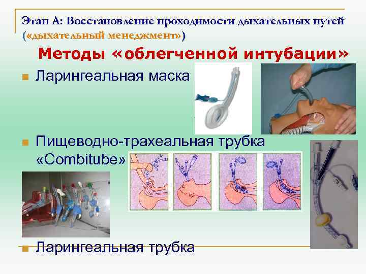 Этап А: Восстановление проходимости дыхательных путей ( «дыхательный менеджмент» ) n Методы «облегченной интубации»