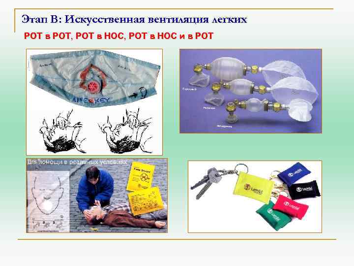 Этап В: Искусственная вентиляция легких РОТ в РОТ, РОТ в НОС и в РОТ