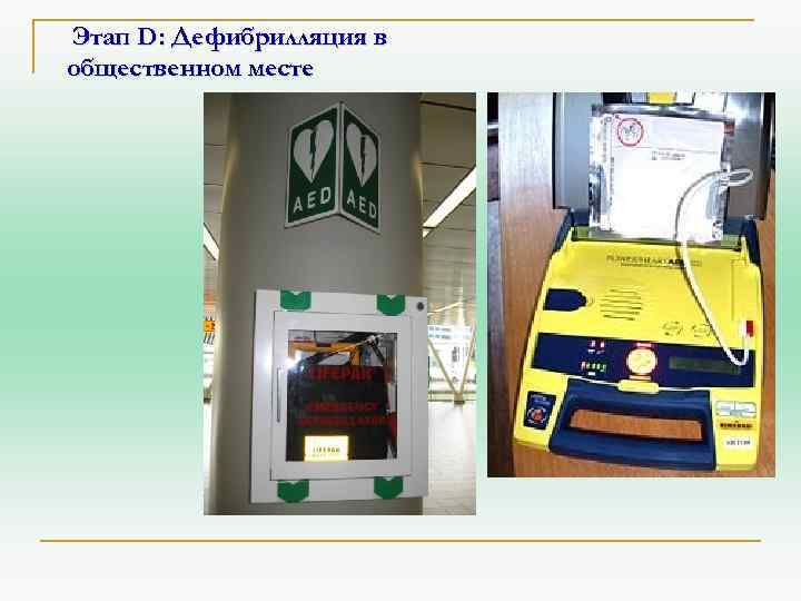 Этап D: Дефибрилляция в общественном месте 