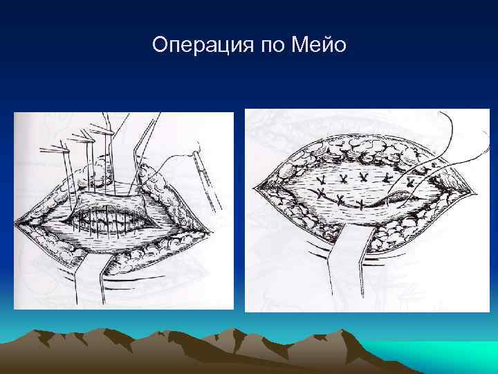 Мост мейо и остров бель карта