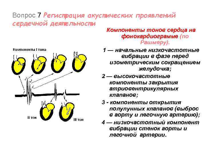 Вопрос 7 Регистрация акустических проявлений сердечной деятельности Компоненты тонов сердца на фонокардиограмме (по Рашмеру).