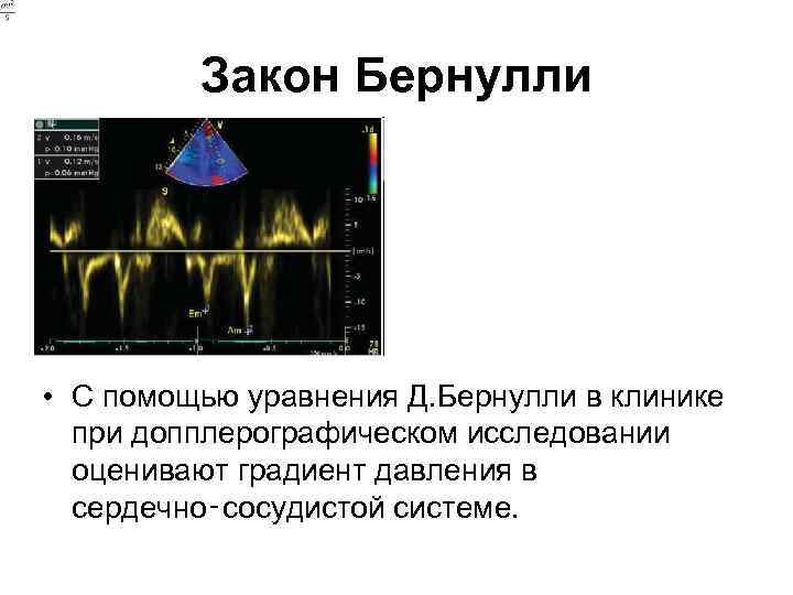 Закон Бернулли • С помощью уравнения Д. Бернулли в клинике при допплерографическом исследовании оценивают