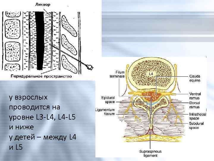 у взрослых проводится на уровне L 3 -L 4, L 4 -L 5 и