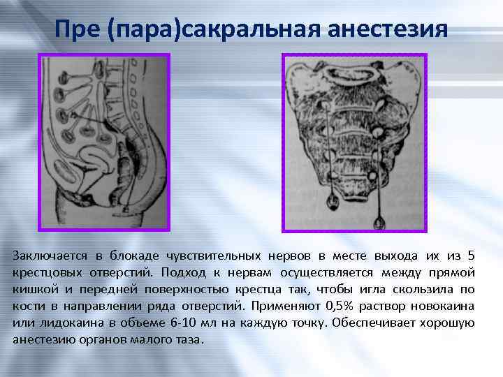 Анестезия по брауну