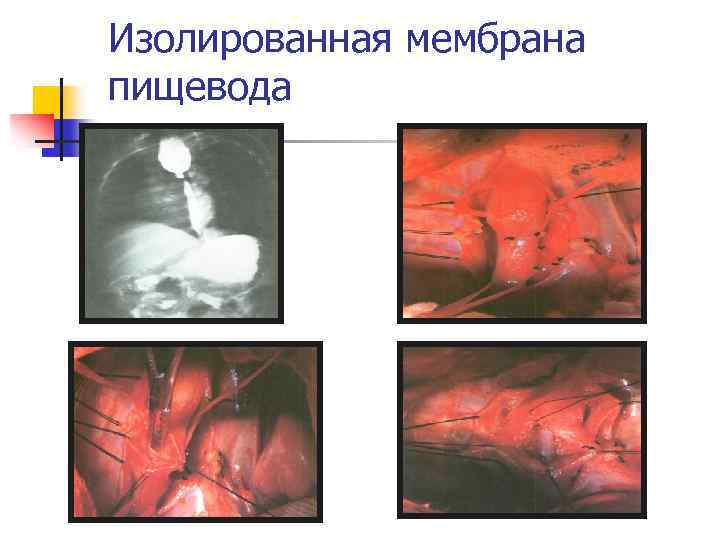 Изолированная мембрана пищевода 