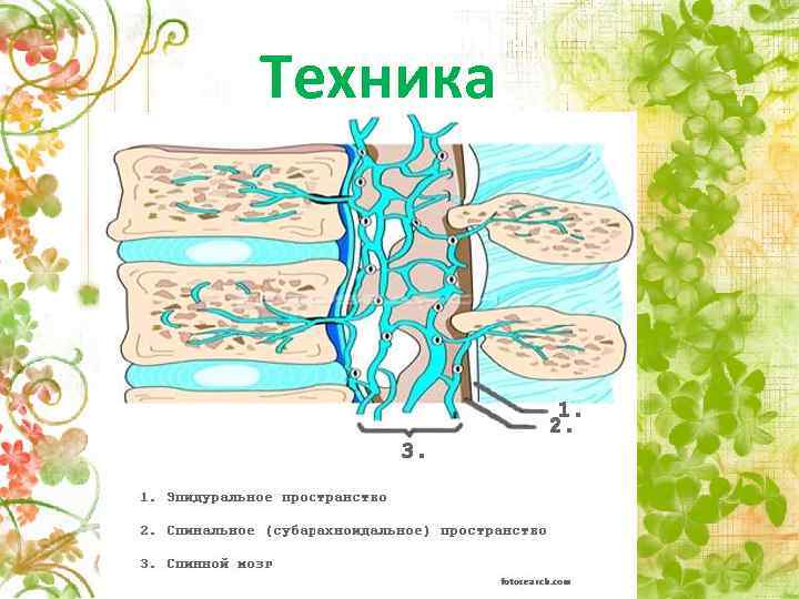 Техника 