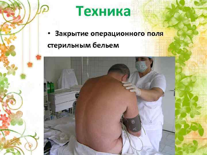 Техника • Закрытие операционного поля стерильным бельем 