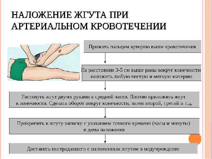 Правила наложения жгута 