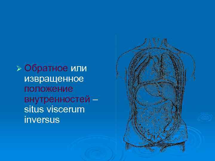 Ø Обратное или извращенное положение внутренностей – situs viscerum inversus 