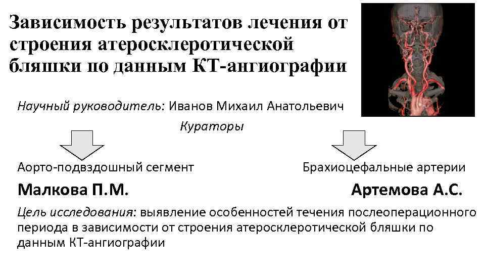 Зависимость результатов лечения от строения атеросклеротической бляшки по данным КТ-ангиографии Научный руководитель: Иванов Михаил