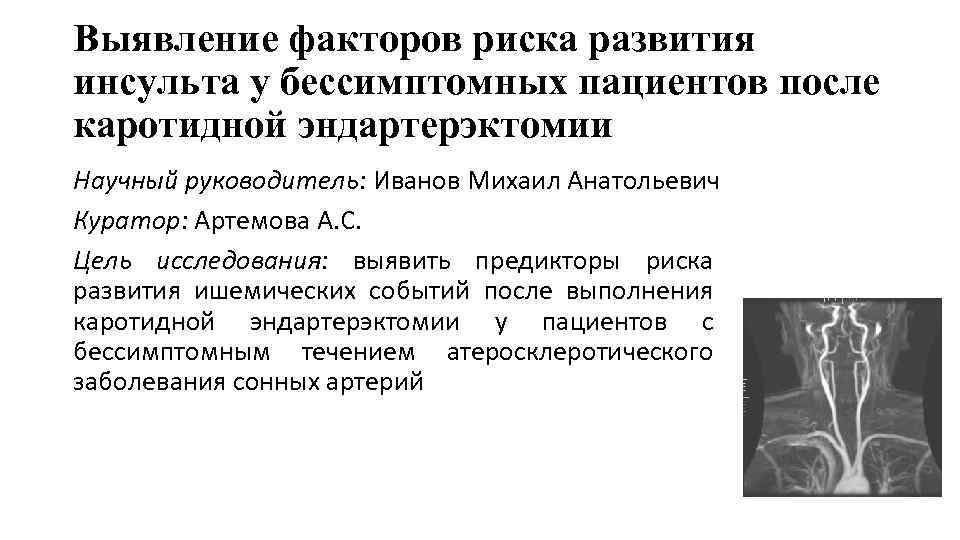 Выявление факторов риска развития инсульта у бессимптомных пациентов после каротидной эндартерэктомии Научный руководитель: Иванов