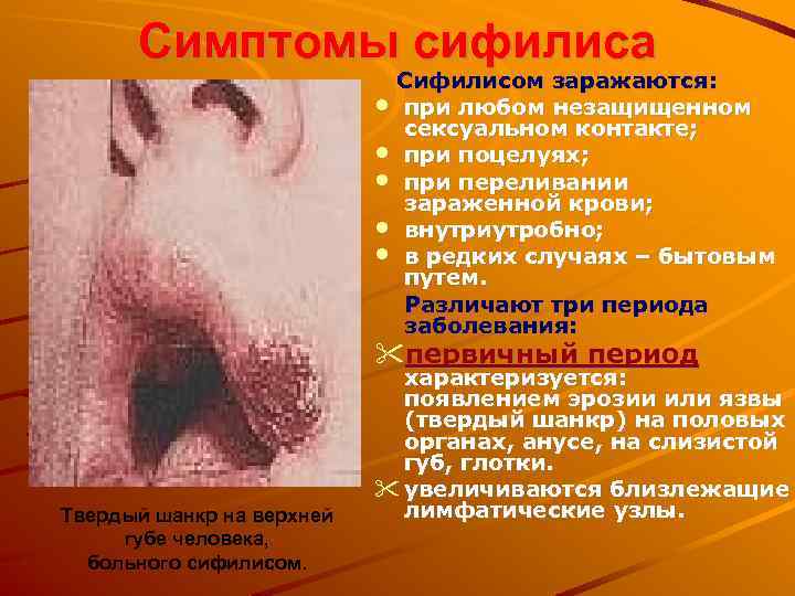 Симптомы сифилиса Сифилисом заражаются: • при любом незащищенном сексуальном контакте; • при поцелуях; •