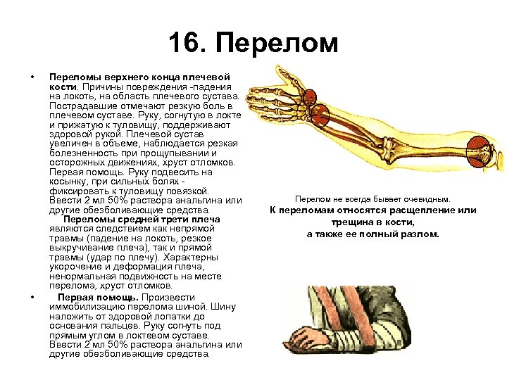 16. Перелом • • Переломы верхнего конца плечевой кости. Причины повреждения -падения на локоть,