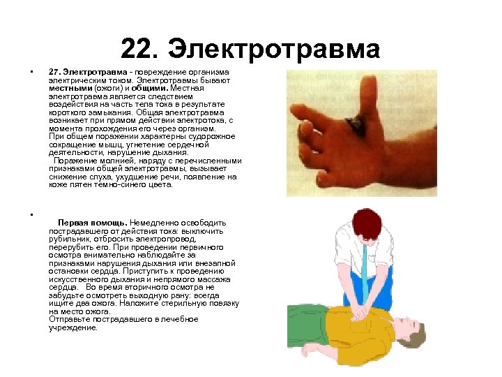 22. Электротравма • 27. Электротравма - повреждение организма электрическим током. Электротравмы бывают местными (ожоги)