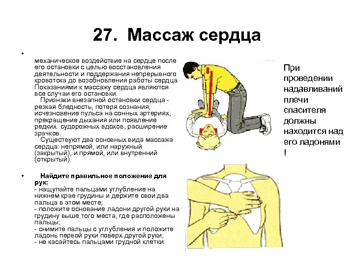 27. Массаж сердца • • механическое воздействие на сердце после его остановки с целью
