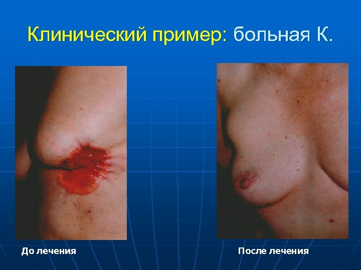 Клинический пример: больная К. До лечения После лечения 