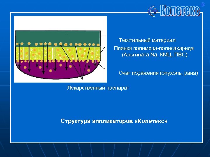 ® Текстильный материал Пленка полимера-полисахарида (Альгината Na, КМЦ, ПВС) Очаг поражения (опухоль, рана) Лекарственный