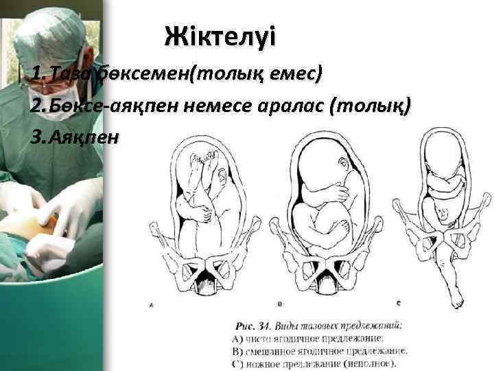 Жіктелуі 1. Таза бөксемен(толық емес) 2. Бөксе-аяқпен немесе аралас (толық) 3. Аяқпен Pro. Power.