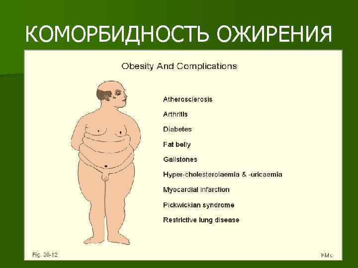 КОМОРБИДНОСТЬ ОЖИРЕНИЯ 