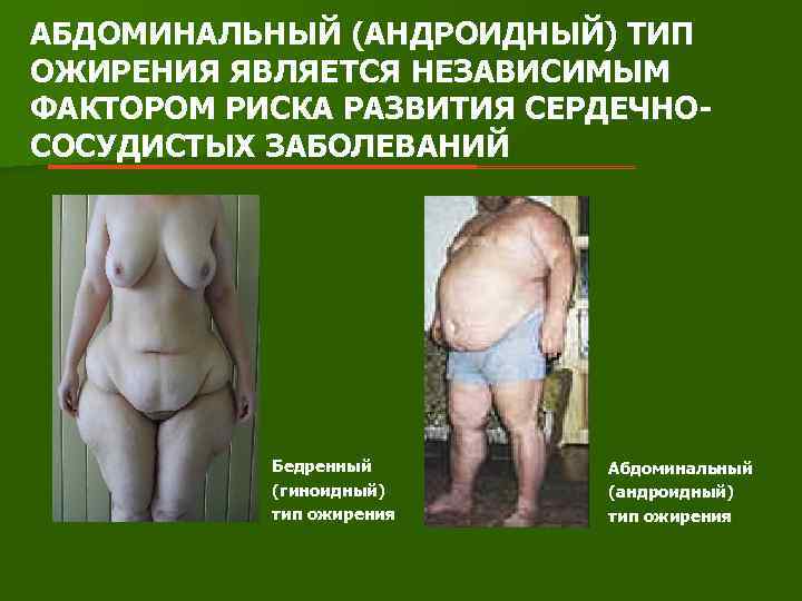 АБДОМИНАЛЬНЫЙ (АНДРОИДНЫЙ) ТИП ОЖИРЕНИЯ ЯВЛЯЕТСЯ НЕЗАВИСИМЫМ ФАКТОРОМ РИСКА РАЗВИТИЯ СЕРДЕЧНОСОСУДИСТЫХ ЗАБОЛЕВАНИЙ Бедренный (гиноидный) тип