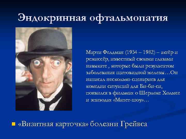 Эндокринная офтальмопатия Марти Фелдман (1934 – 1982) – актёр и режиссёр, известный своими глазами