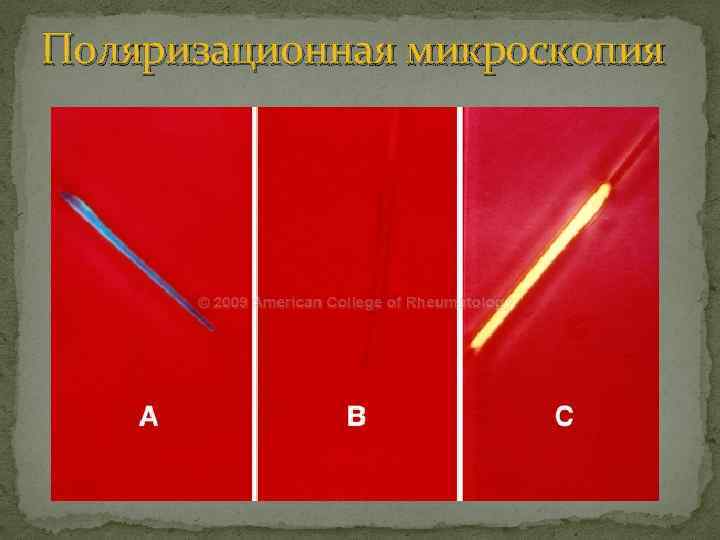 Поляризационная микроскопия 