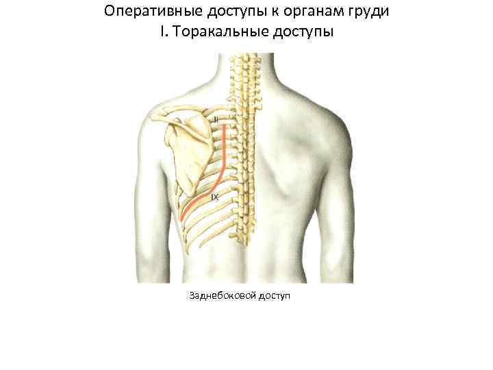 Оперативные доступы к органам груди I. Торакальные доступы Заднебоковой доступ 